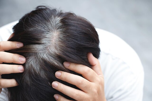 نشانه احتمالی ابتلا به پارکینسون در موها پنهان است