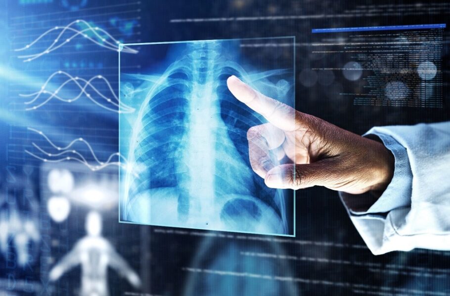 محققان گوگل: هوش مصنوعی تخصصی Med-Gemini در زمینه پزشکی بهتر از GPT-4 عمل می‌کند