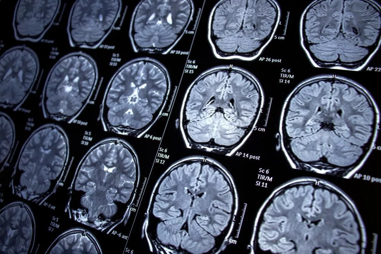 پژوهشی جدید: مغز انسان درحال بزرگ‌ترشدن است